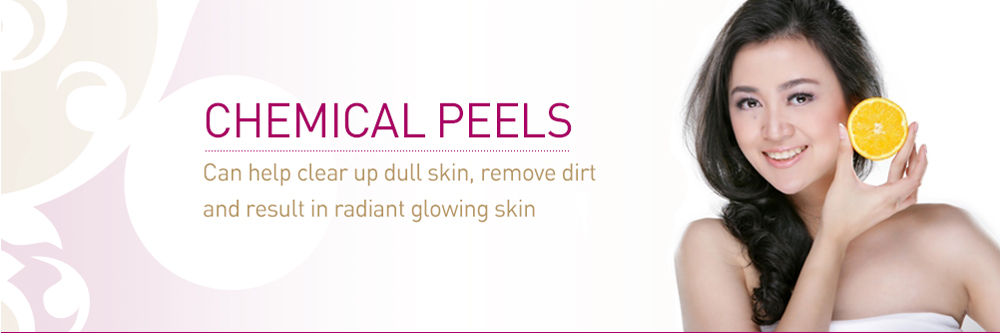 Chemical Peels