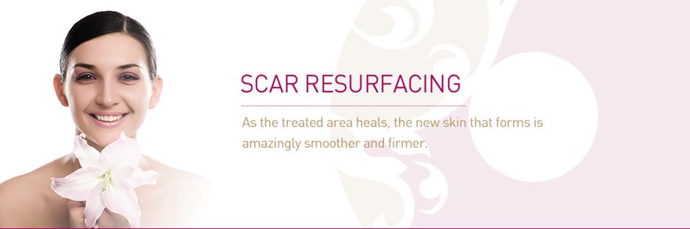 scar-resurfacing.jpg