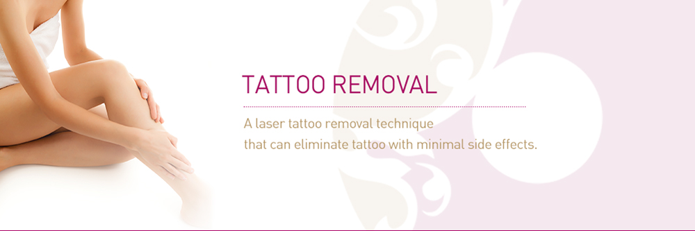 tattoo-removal.jpg