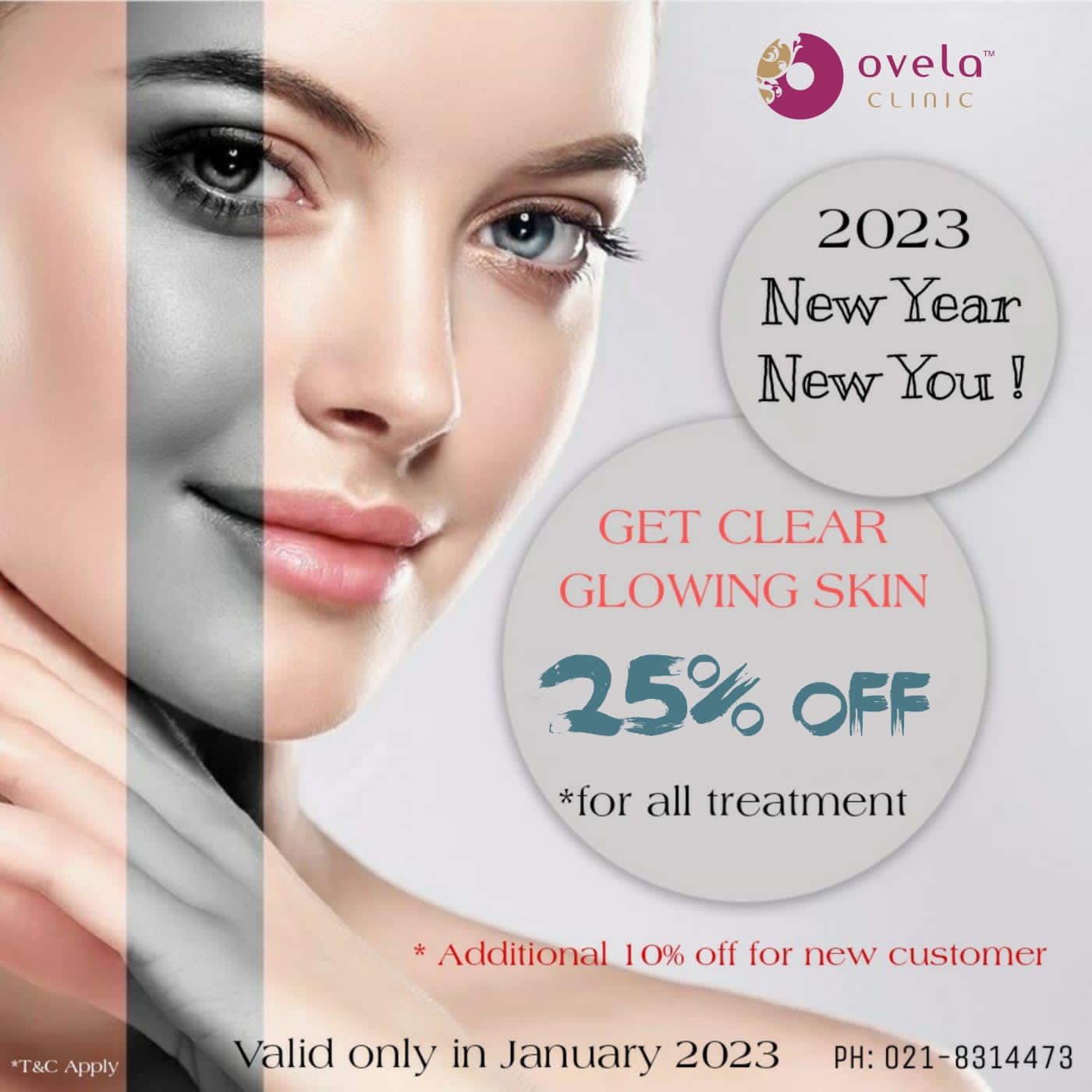 January Promotion